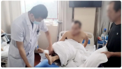 粉碎性骨折，医生为何不给他做手